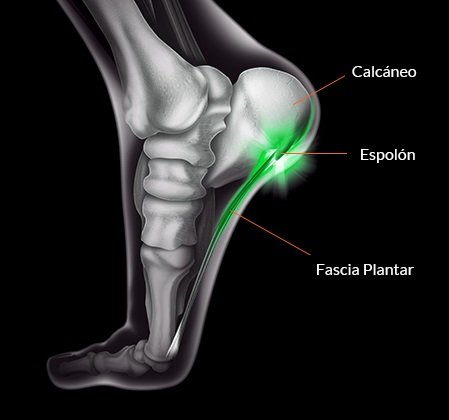 plantillas ultradelgadas cuero ortopedia maipu vicente lopez